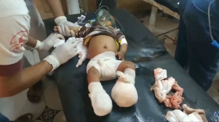 فيديو مؤلم.. طفل بعمر 4 أشهر ينضم لقائمة ضحايا مجزرة الحديدة