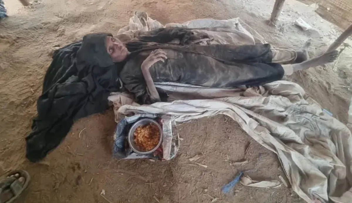 مأساة في حجة.. الجوع يطوي حياة زوجين نازحين داخل مخيم خاضع للحوثيين