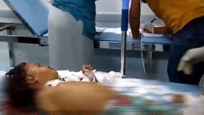 إصابة 6 مدنيين بينهم 4 أطفال بقصف حوثي على حيس