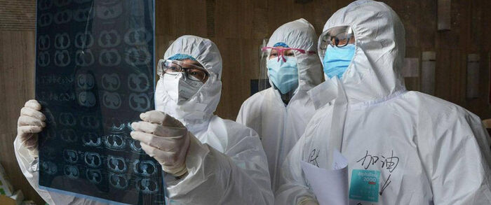 كيف يغزو كورونا الرئتين وماذا يفعل بهما؟