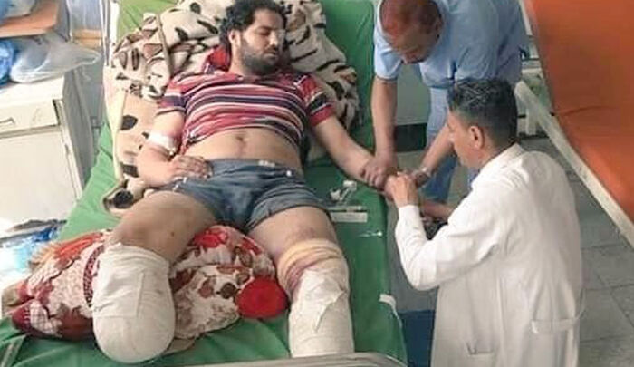 استشهاد طفلين وإصابة مدنيين إثر انفجار لغم حوثي في البيضاء وتعز