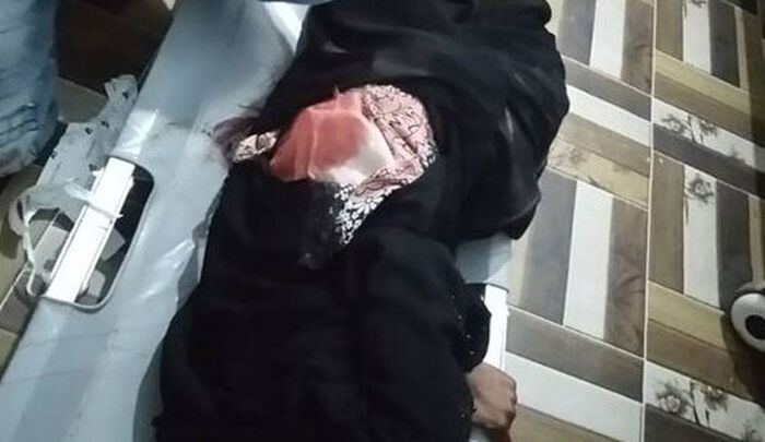 إصابة امرأة بنيران المليشيا الحوثية في مدينة حيس