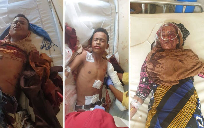 إصابة ثلاثة أطفال وامرأة بعملية إرهابية حوثية جديدة في تعز