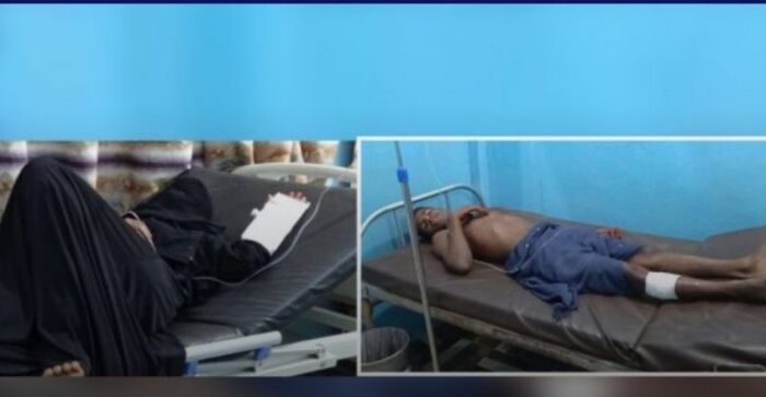 إصابة مدنيان بينهما امرأة نتيجة استهداف حيس من قبل المليشيا