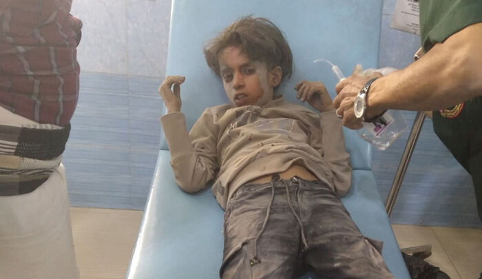 مليشيا الحوثي ترتكب جريمة جديدة بقصف أحياء تعز.. وإصابة طفل وفتاة