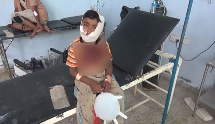 إصابة طفل برصاص قناصة مليشيا الحوثي في مديرية حيس غربي اليمن