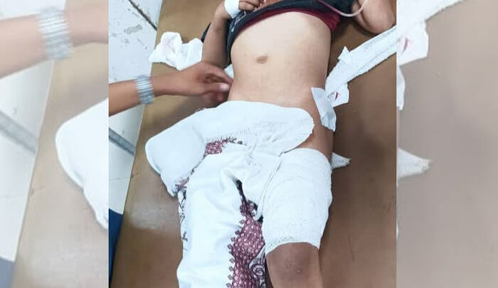 إصابة طفل برصاص قناص حوثي في تعز