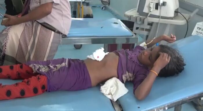 إصابة طفلة برصاص مليشيا الحوثي في مديرية حيس (فيديو)