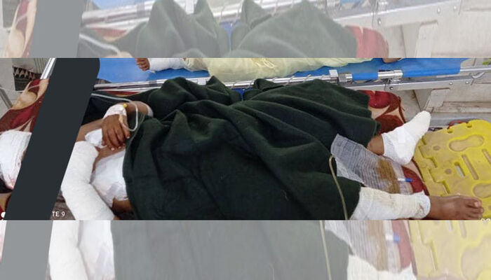 إصابة طفلين بلغم حوثي في حريب مأرب