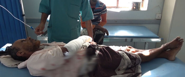 فيديو.. إصابة يمني بقصف حوثي