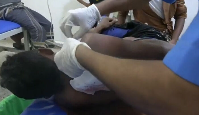 إصابة مواطن يمني برصاص قناص حوثي في التحيتا