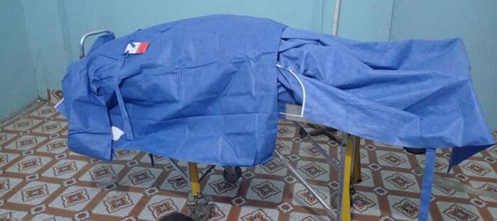 إستشهاد إمرأة برصاص قناص حوثي في حيس غربي اليمن