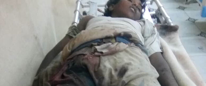 استشهاد طفل بانفجار لغم حوثي جنوبي الحديدة