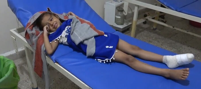 إصابة طفلة بطلق ناري حوثي في التحيتا غربي اليمن