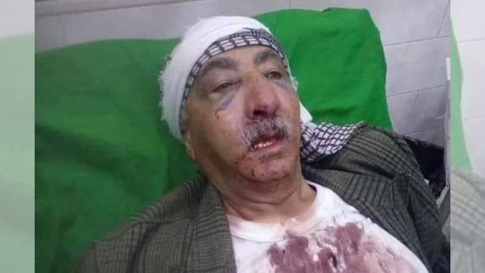 الحوثي يواصل إهانة القبائل.. ويقتحمون منزل شيخ قبلي بعمران ويعتدون عليه