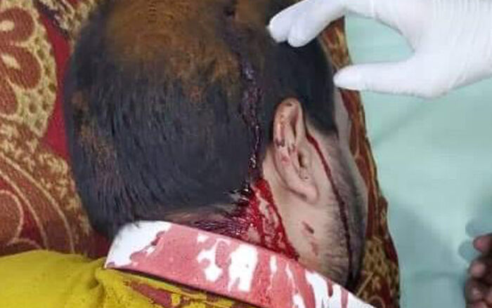 الحوثيون يعتدون على رجل الأعمال أحمد الكبوس بصنعاء