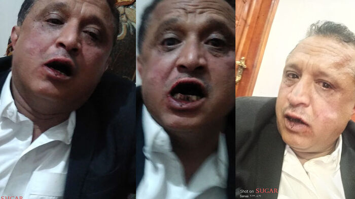 الحوثيون يعتدون بالضرب المبرح على مدير إذاعة "صوت اليمن"