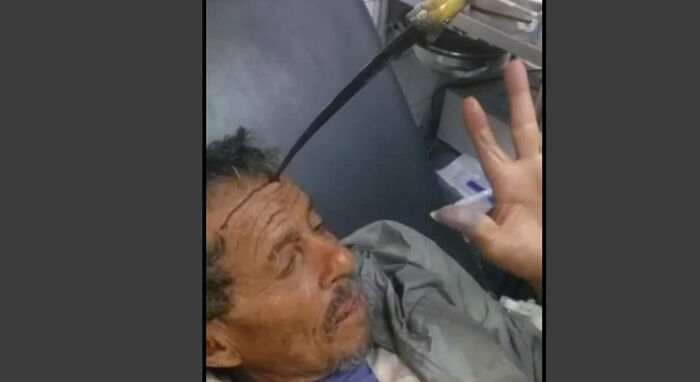 حوثي يعتدي على مسن بالطعن - صور