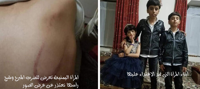 مليشيا الحوثي تقتحم منزلين بصنعاء وتعتدي على النساء والأطفال