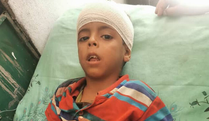 مصادر محلية: إصابة طفل بقصف حوثي على قرى ثرة في أبين