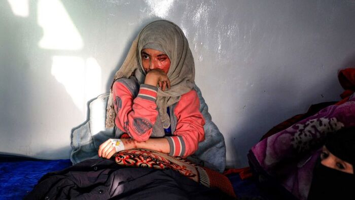 في عهد الحوثي.. العنف ضد النساء  لا يتوقف!