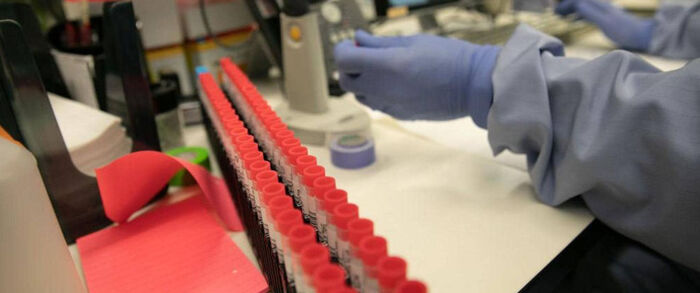 انتشار التهاب رئوي مميت في النصف الثاني من 2020