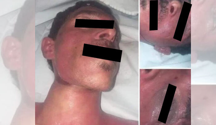 مشهد من سجون الحوثي.. مقتل مواطن متأثرًا بالتعذيب في صعدة