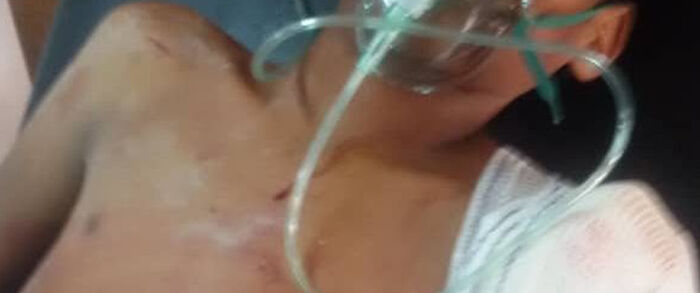 إصابة مواطن بقذيفة حوثية لقرية الشجيرة بالدريهمي