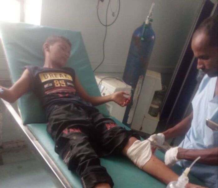 السلطة المحلية بمحافظة الحديدة تدين جريمة المليشيا الحوثية بحق الطفولة في حيس