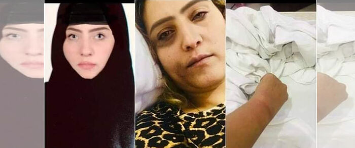 ناشطة حقوقية: الحوثيون يغتصبون النساء في سجونهم