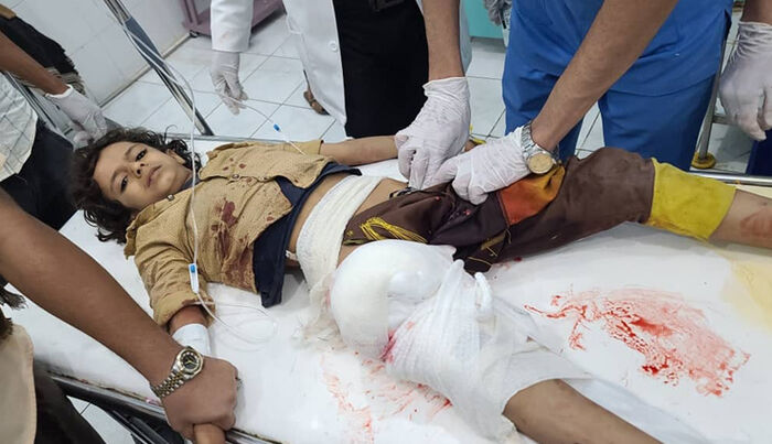 رابطة حقوقية يمنية: الحوثي تسبب بمقتل وإصابة أكثر من 14 ألف طفلاً منذ بدء الحرب