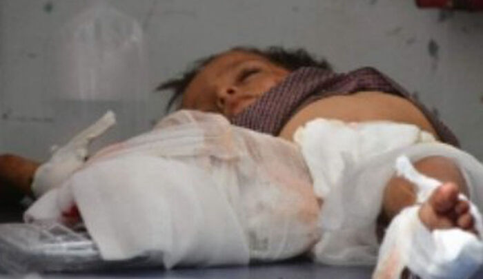 في خرق متواصل للهدنة الأممية.. إصابة طفل برصاص قناص حوثي شرقي محافظة تعز