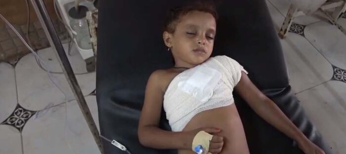 الحوثيون يقتلون الأطفال وكبار السن في الفازة بطريقة متعمدة