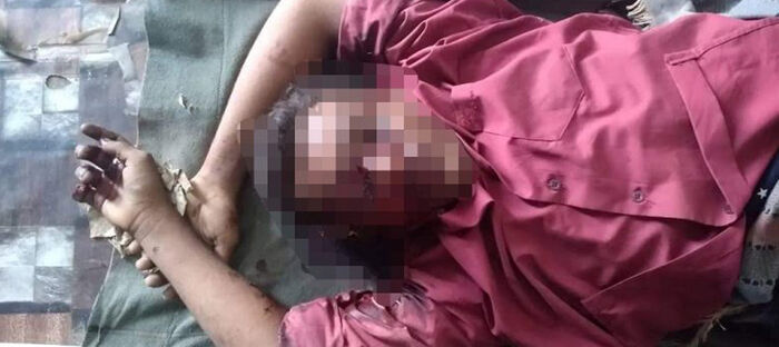 استشهاد مواطن نتيجة انفجار لغم حوثي في حيس جنوبي الحديدة