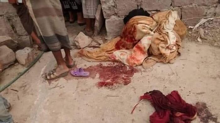 تعز.. شاب متأثر بالتطرف الحوثي يذبح والدته ويطعن عائلته