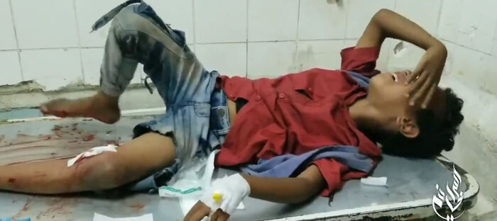 أطباء بلا حدود: 16 مصابا معظمهم مدنيون بقصف حوثي على تعز