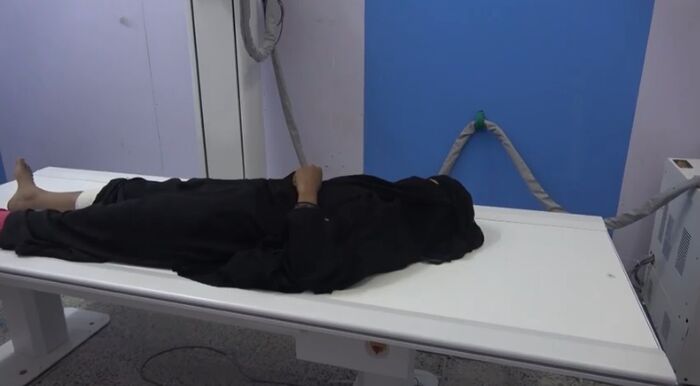 إصابة امرأة في حيس برصاص قناصة المليشيا الحوثية (فيديو)