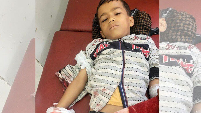 إصابة طفل برصاص قناص حوثي في تعز