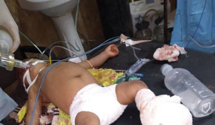 مجزرة حوثية مروعة بحق نساء وأطفال الفازة غربي اليمن (فيديو)