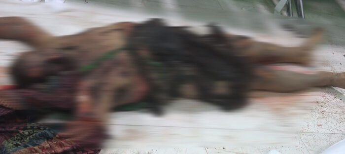 مشاهد جديدة لضحايا المجزرة التي إرتكبتها مليشيا الحوثي في مجمع إخوان ثابت في الحديدة