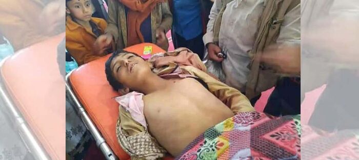 استشهاد طفل برصاص قناصة مليشيا الحوثي أمام منزله في الضالع جنوبي اليمن