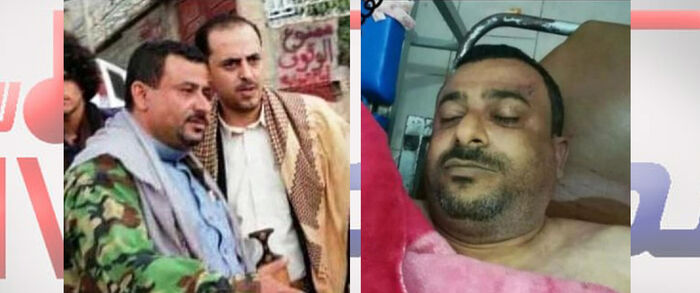 مقتل قياديين حوثيين في إب بسبب «سرقة المساعدات»