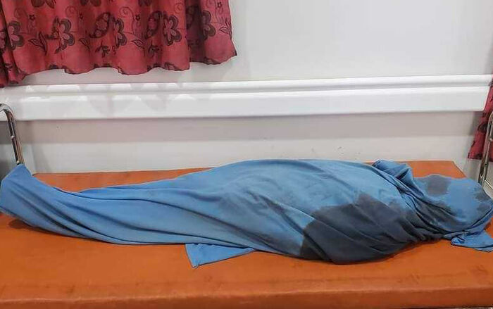 مقتل امرأة برصاص قناصة مليشيات الحوثي غرب تعز