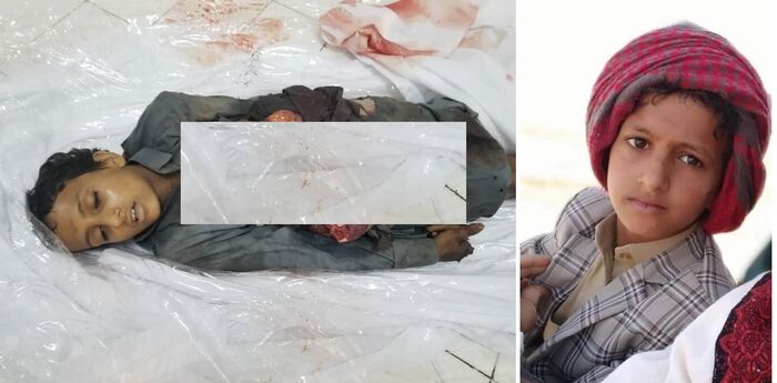 مقتل وجرح 13 شخصًا بينهم طفل في قصف بالستي حوثي على مأرب