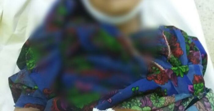 تعز.. استشهاد طفلة في الوازعية بانفجار لغم من مخلفات مليشيات الحوثي