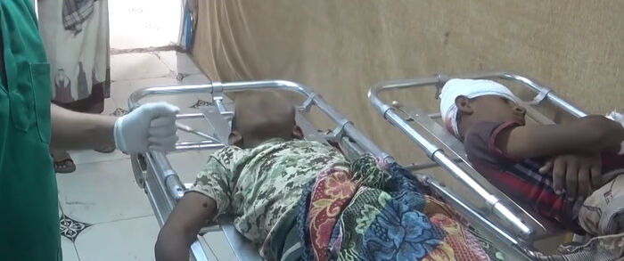 مقتل طفلين بلغم حوثي في الدريهمي غربي اليمن